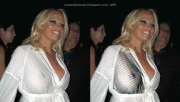 Pamela Anderson XRay